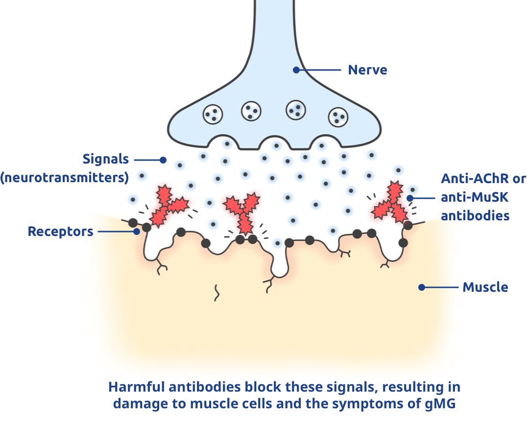 Harmful antibodies block these signals, resulting in damage to muscle cells and the symptoms of gMG.