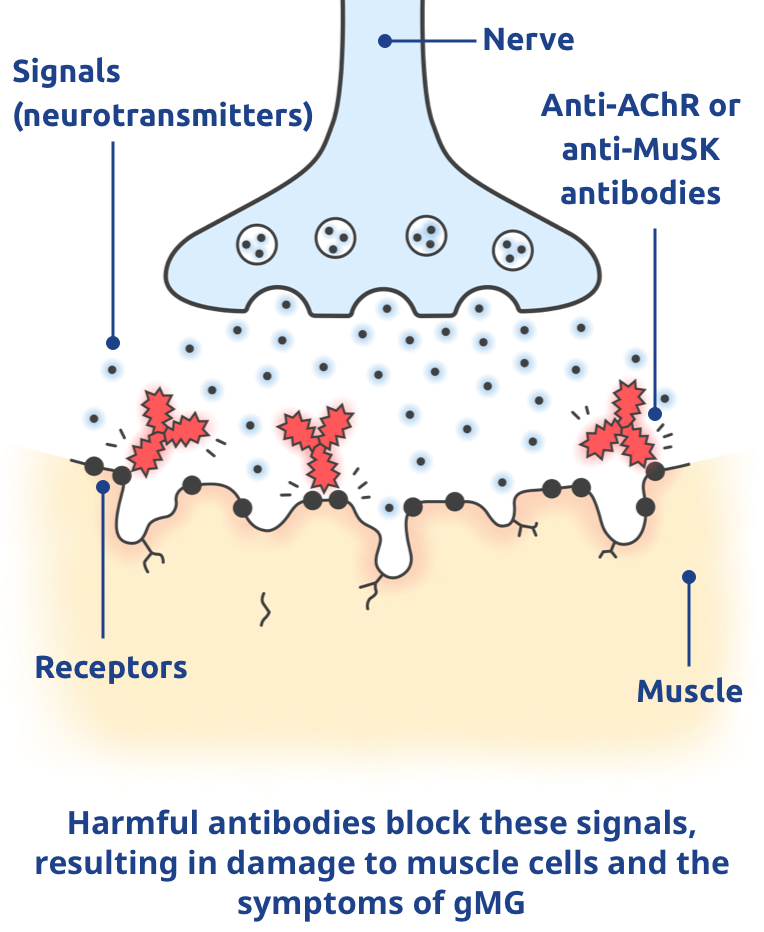 Harmful antibodies block these signals, resulting in damage to muscle cells and the symptoms of gMG.