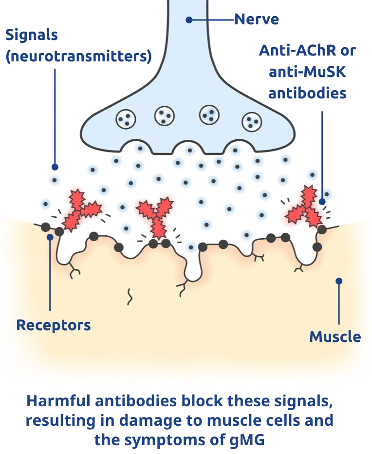 Harmful antibodies block these signals, resulting in damage to muscle cells and the symptoms of gMG.